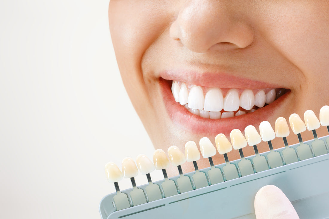 Secrets of Teeth Whitening at Home